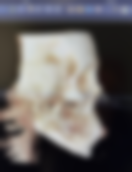 西安健丽医美宋媛医生患者评价