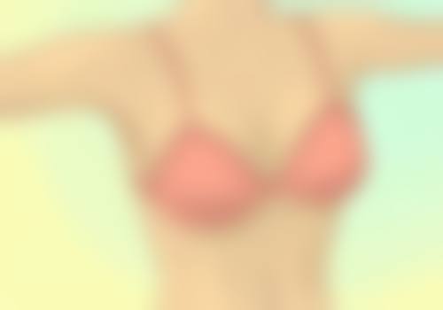 河南大学附属南石医院烧伤整形美容中 心赵学建医生擅长项目