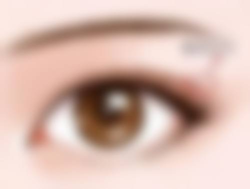 安徽医 科 大学第二附属医院娄寅医生双眼皮技术怎么样？