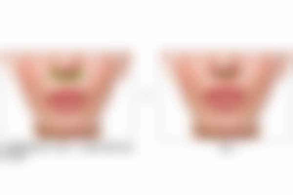 北京蕾士悦容医疗美容门诊部丁玉杰医生擅长项目