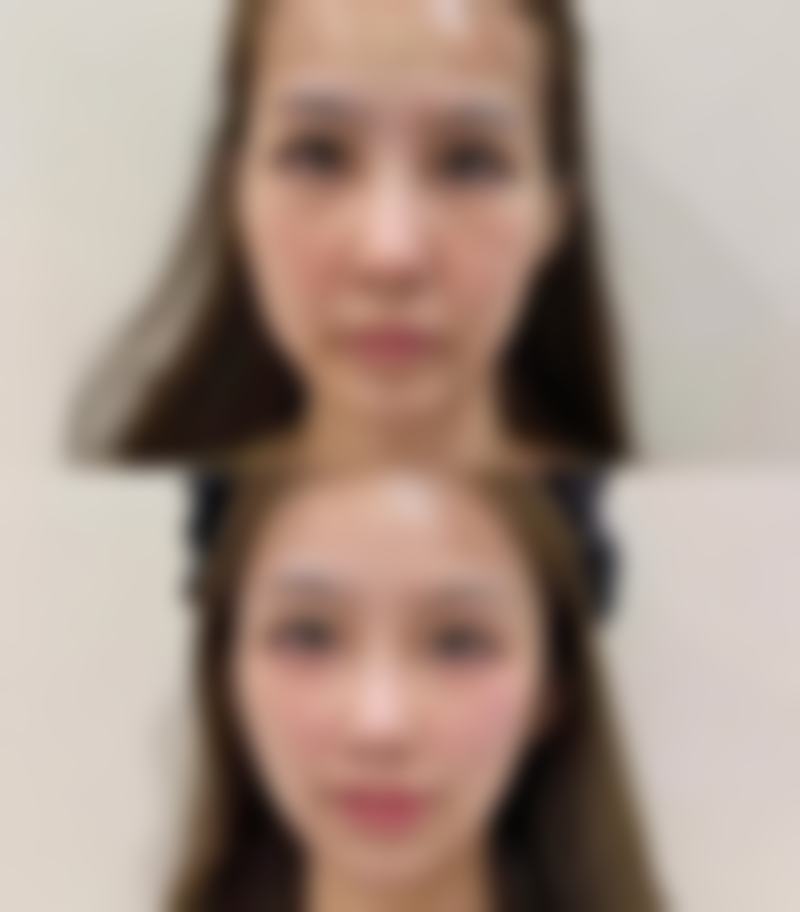 北京仁雁医疗美容门诊部张学艳医生眼部综合整形技术怎么样？