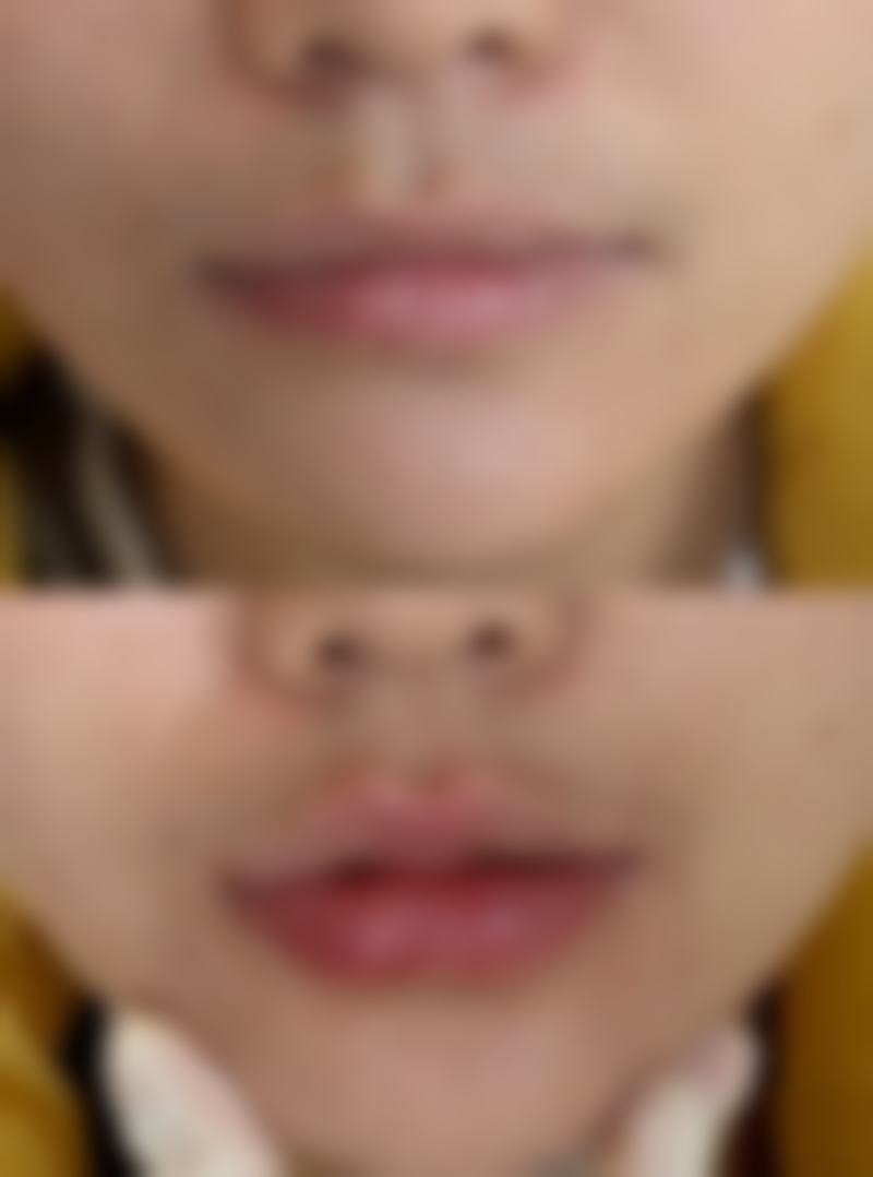 西安未央嘉美和韵整形医院口碑评价怎么样？