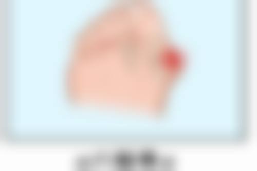 河南大学附属南石医院烧伤整形美容中 心杨国明医生擅长项目