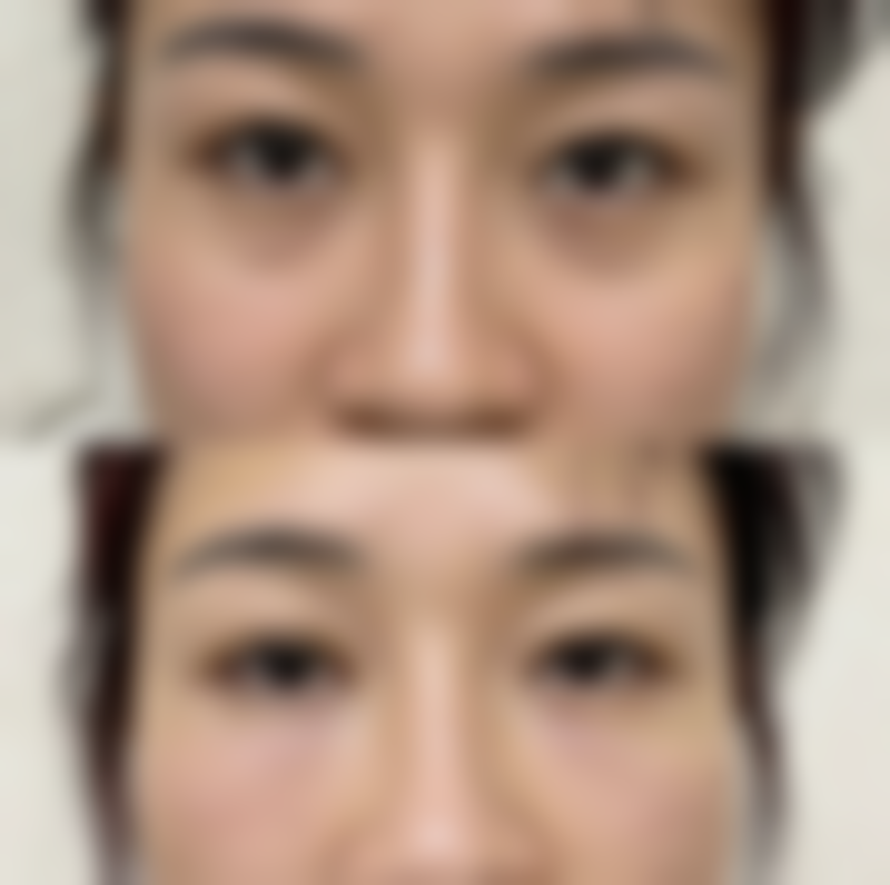 天津华中医疗美容专科医院收费价格表