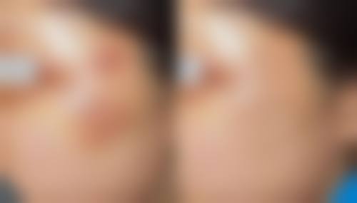 余姚柏合整形医院收费价格表