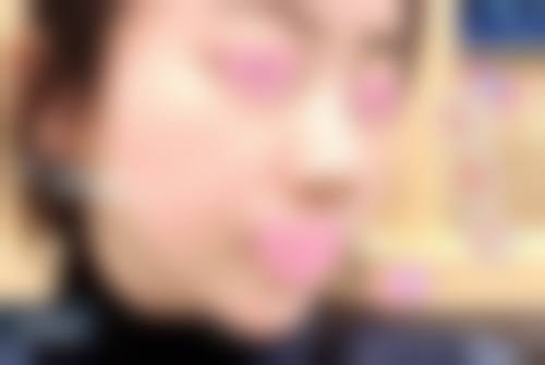 余姚柏合整形医院口碑评价怎么样？