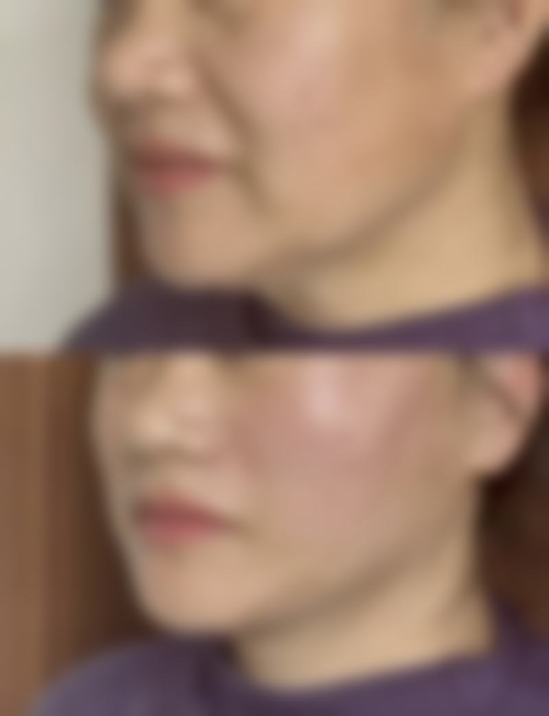 廊坊悦美医疗美容医院安阳医生患者评价