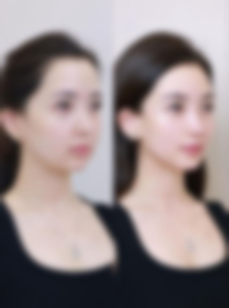 湖南安铂丽美尚医疗美容口碑评价怎么样？