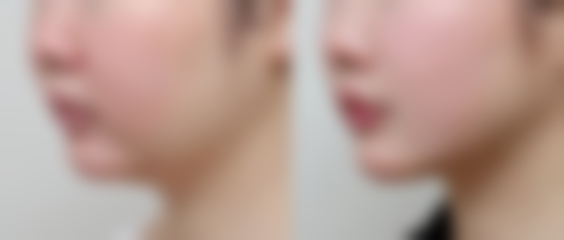 成都高新圣之隅整形医院怎么预约