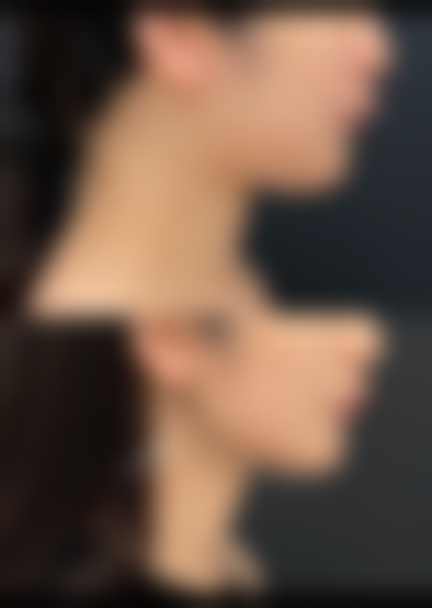 国内人民解放军第457医院整形科正规吗？