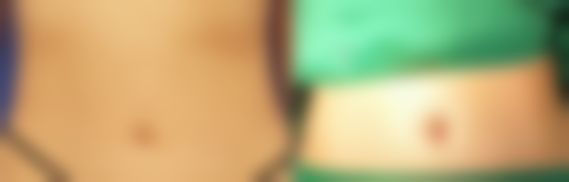 国内人民解放军第457医院整形科医生介绍