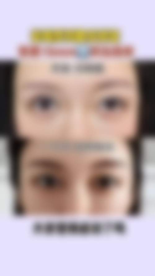 上海德媛医疗美容门诊部杨滨医生患者评价