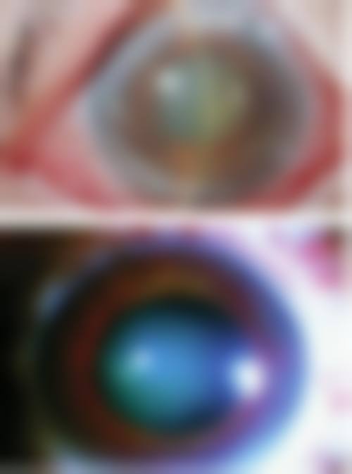 高继托医生擅长项目