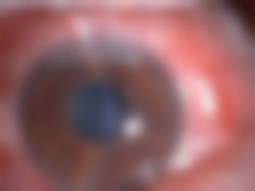 驻马店市第一人民医院眼科预约挂号方式。