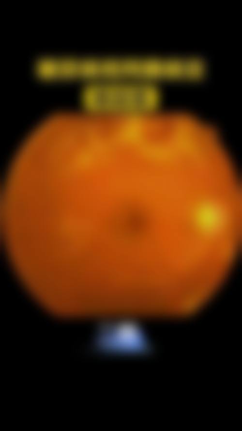 驻马店市第一人民医院眼科口碑评价