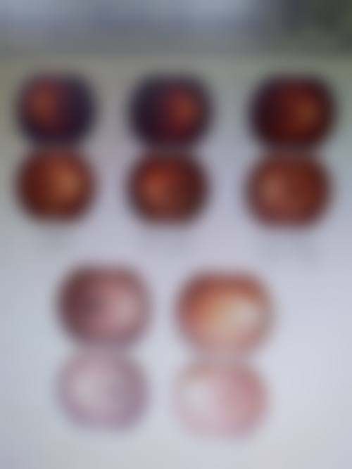 阳新县人民医院眼科治疗反馈与口碑评价。