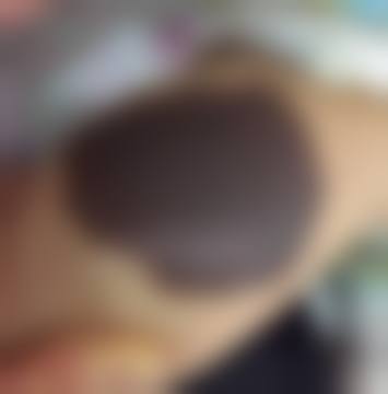 武警广东总队医院整形美容中 心擅长项目。