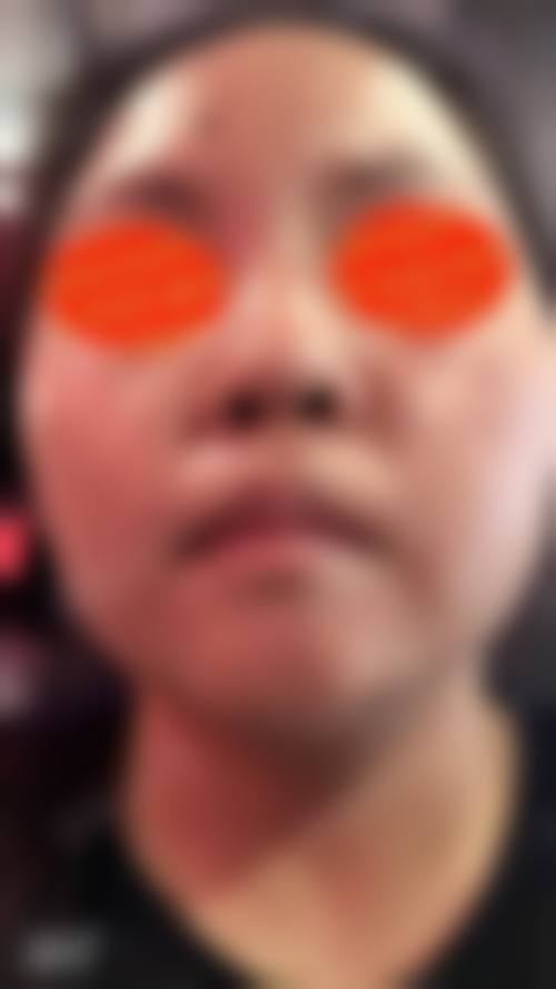 东阳市中医院烧伤整形科治疗反馈与口碑评价。