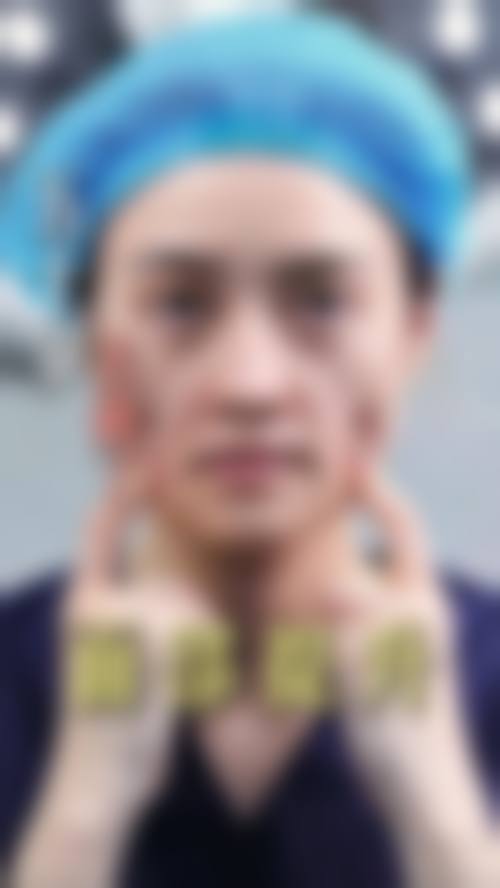 武警广东总队医院整形美容中 心预约挂号方式。