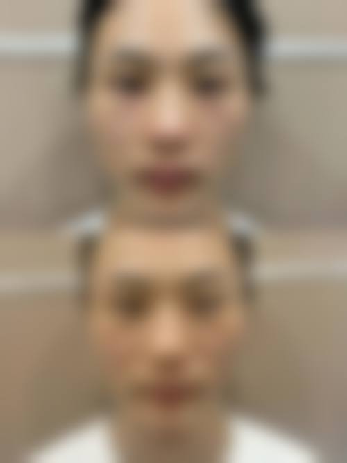 东阳市中医院烧伤整形科擅长项目。