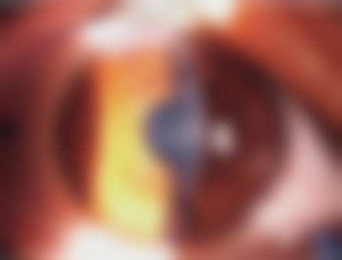 驻马店市第一人民医院眼科2026年价格收费表：