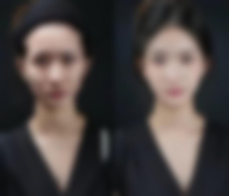 韩国清潭Areum Clinic正规吗？