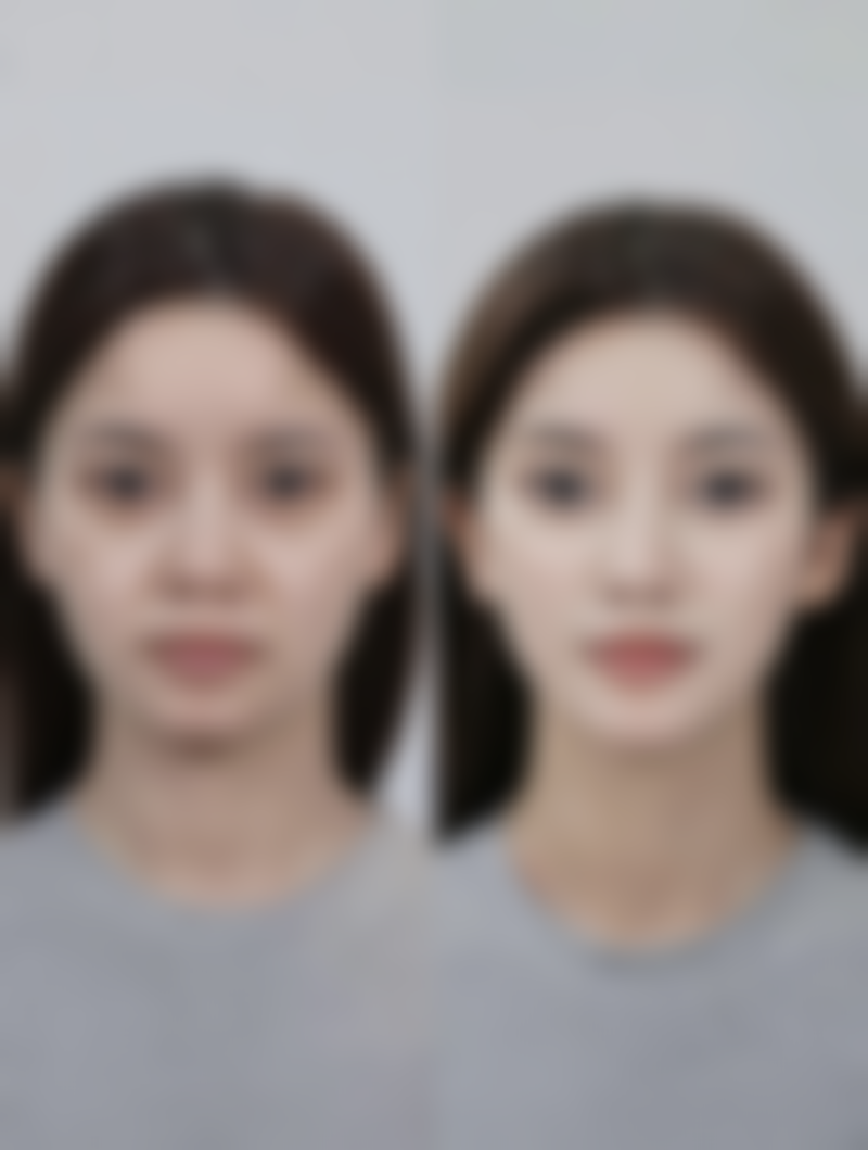 无锡大麦医疗美容诊所刘汉敏医生收费价格