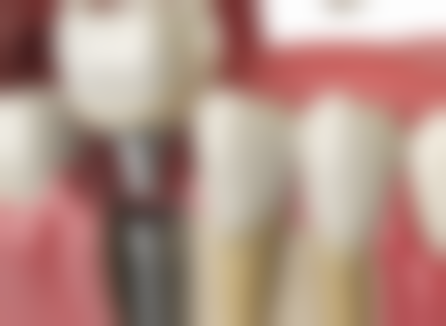 北京贝杰口腔门诊部项目价格