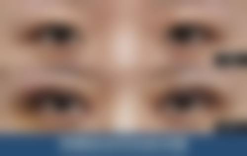 东莞常平铂晨整形医院预约挂号方式。