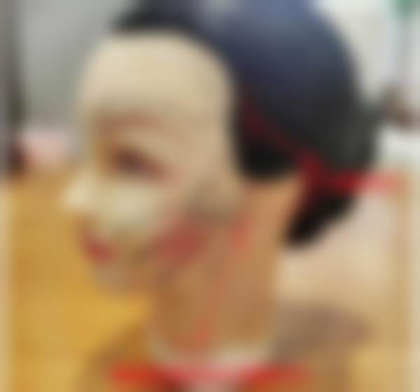北京黄寺医疗美容门诊部李晓东的成功实例