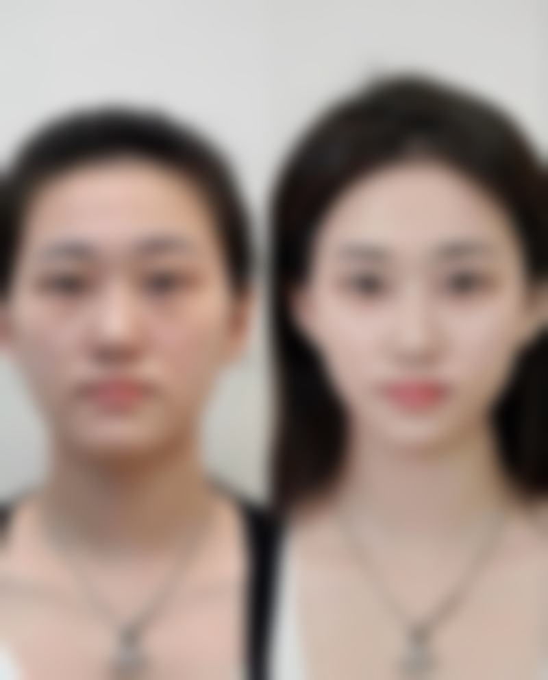 河南大学附属南石医院烧伤整形美容中 心口碑评价