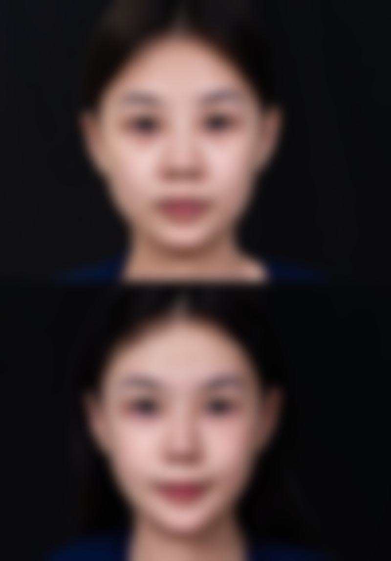 柏杨医生的技术实力