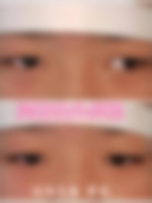 南京江宁眼管家眼科诊所治疗反馈与口碑评价。