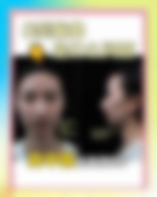 新疆乌鲁木齐瑞红整形治疗反馈与口碑评价。