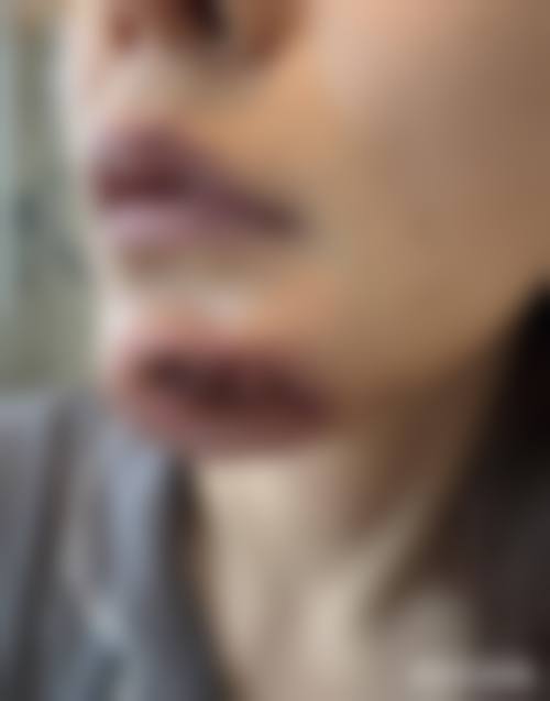 新疆克拉玛依市中 心医院整形美容科治疗反馈与口碑评价。