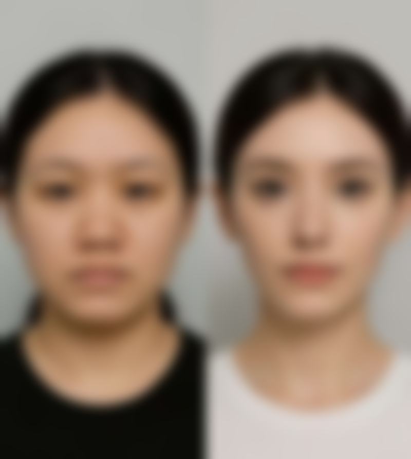 新疆乌鲁木齐瑞红整形擅长项目。