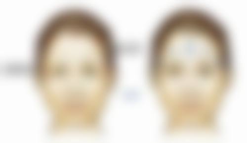 大同圣莲心整形医疗美容诊所正规吗？