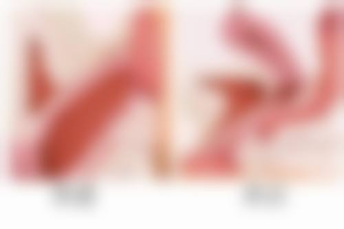 杭州首瑞植发口碑评价怎么样？