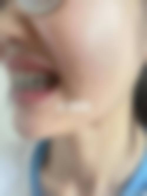 郴州洁美牙科医生团队经验稳定。