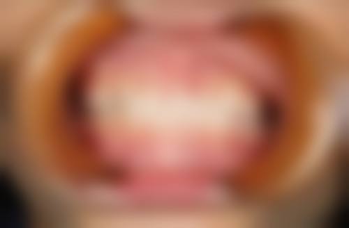 重庆美奥口腔医院预约挂号方式。