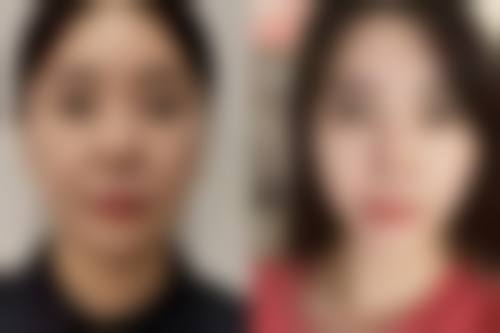 哈尔滨瑞格光谱医疗美容门诊部治疗反馈与口碑评价。