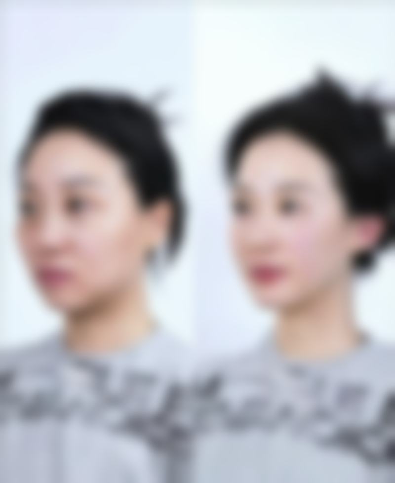 北京星源医疗美容医院王悦医生患者评价