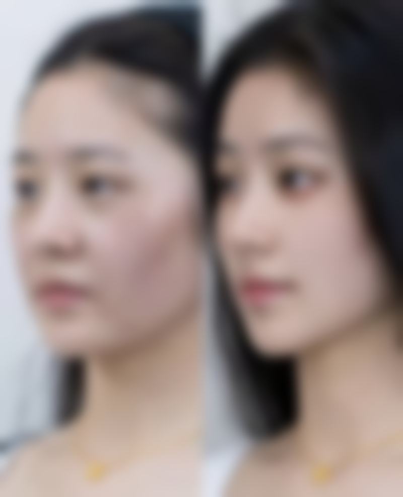 总结