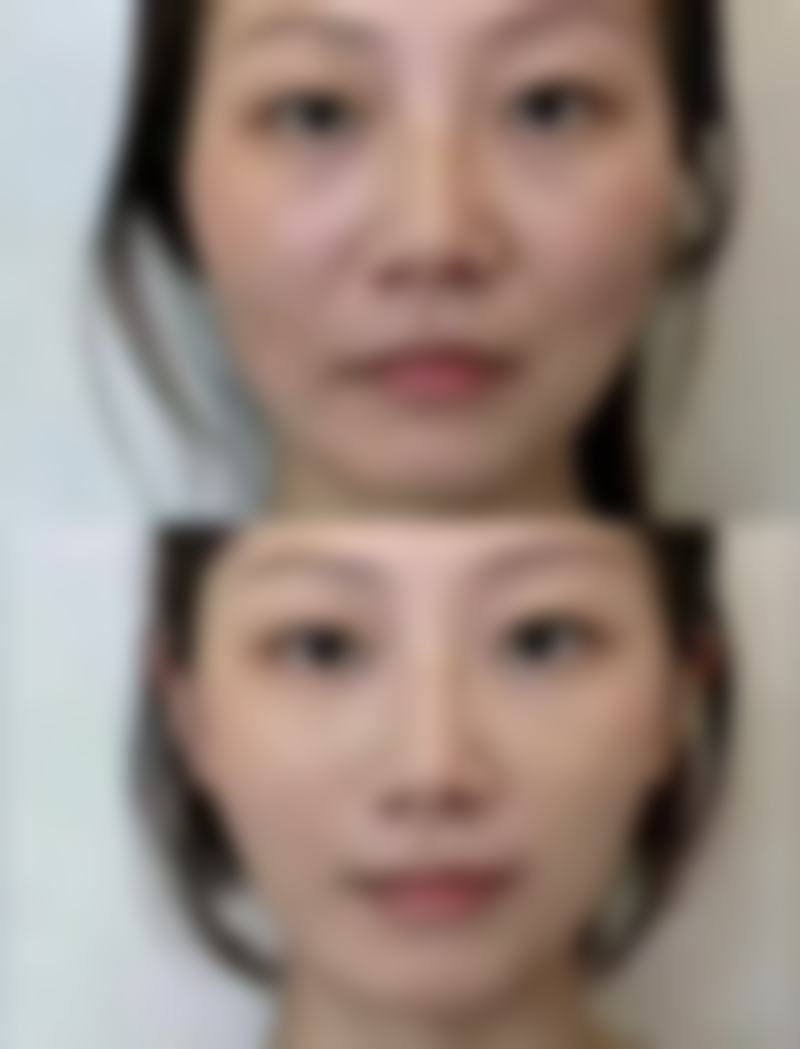 南京澳玛星光整形医院价格情况
