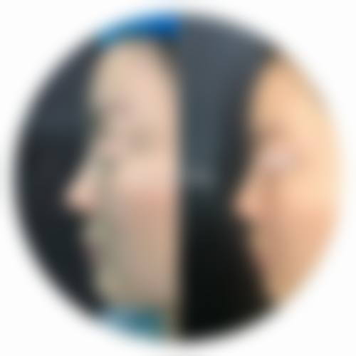 沈阳和平全毅医疗美容诊所擅长项目。