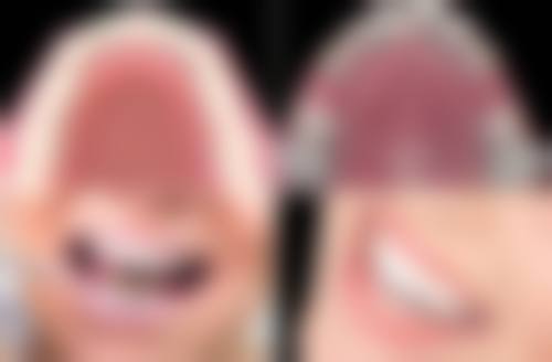 黄晓文医生的技术实力