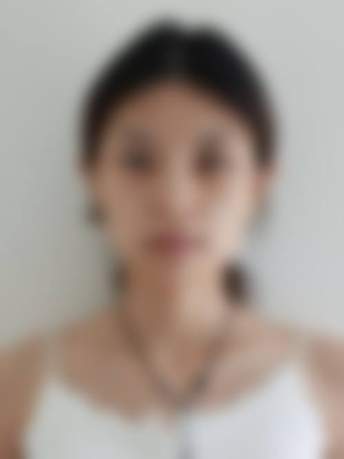 青州市人民医院美容科项目价格