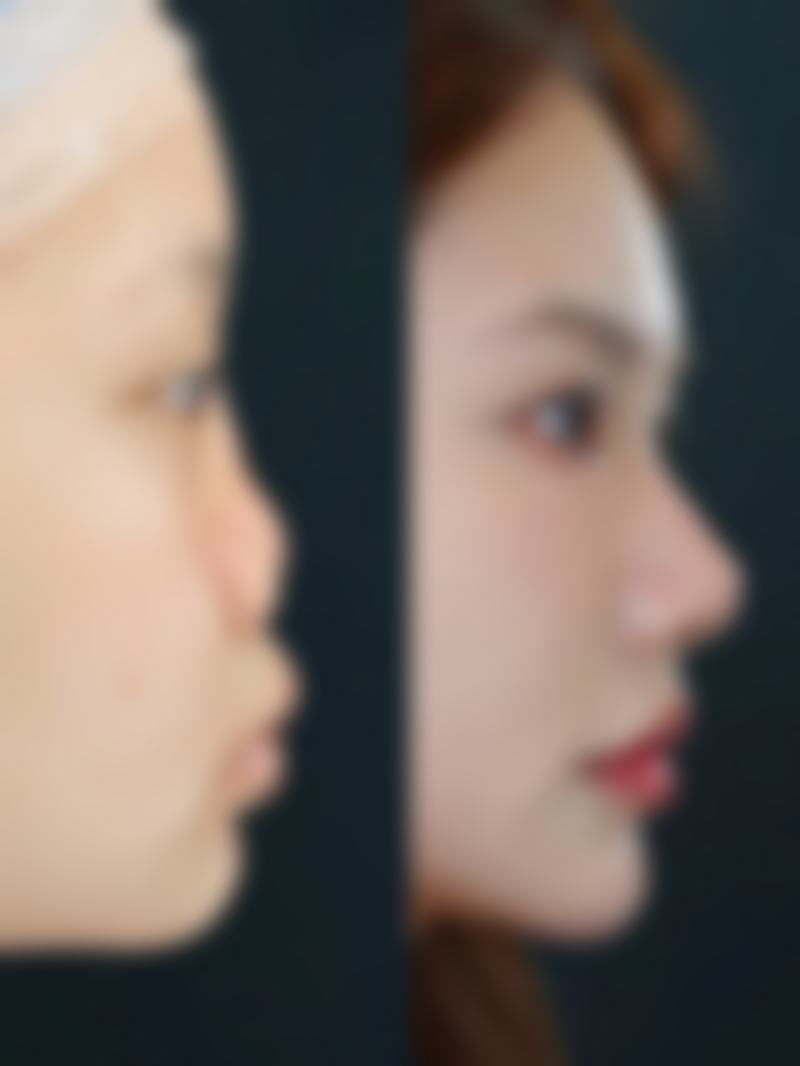 南昌肤美美容医院口碑评价怎么样？