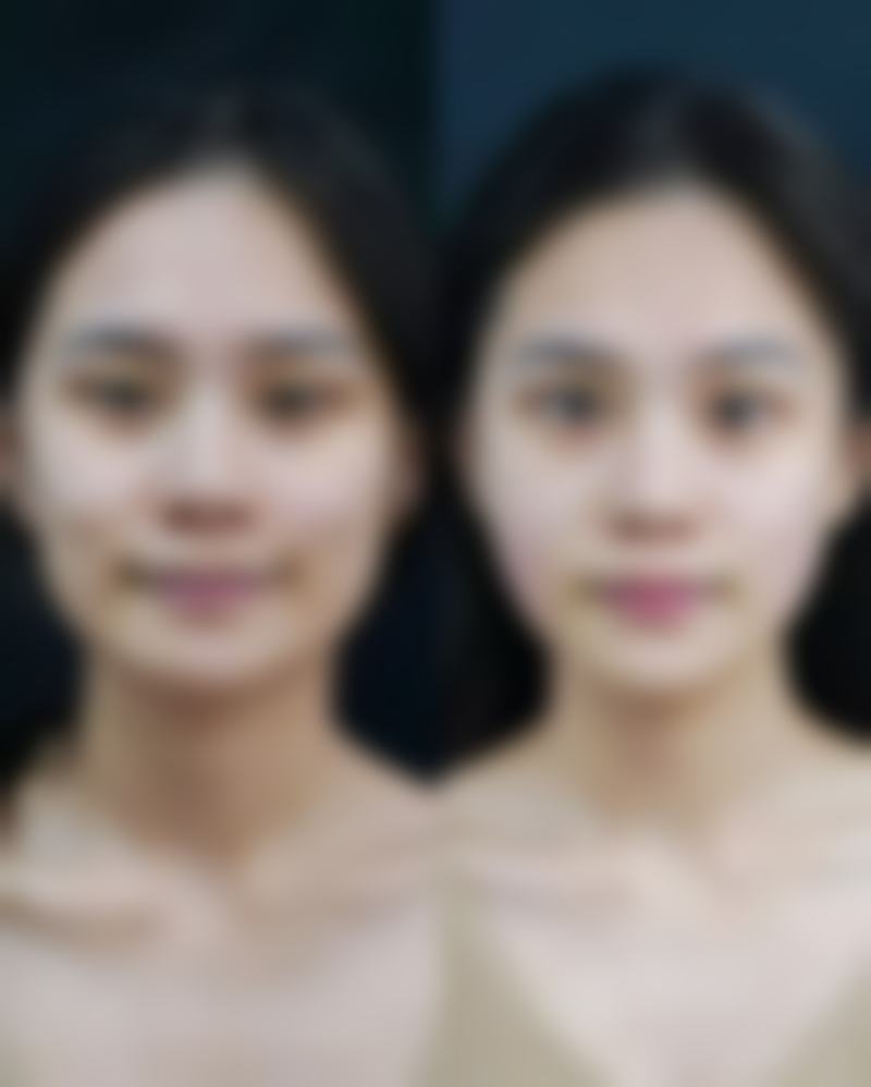 保定宝特医疗美容诊所正规吗？
