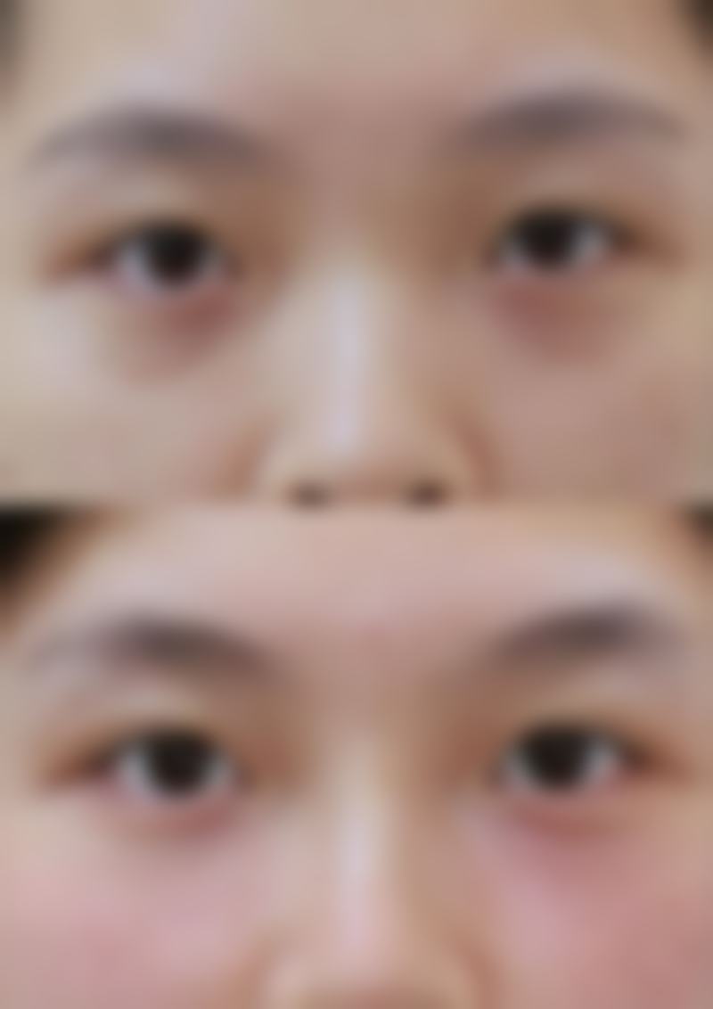 南昌肤美美容医院怎么预约